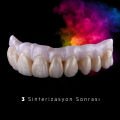 Esthetic Colorant (Basic Kit - 144ml)